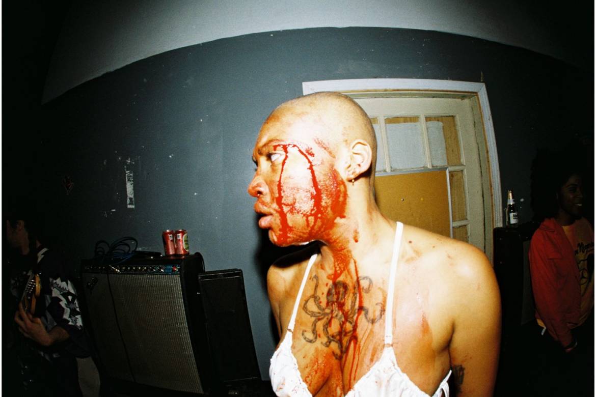 upchuck-bloody.jpg